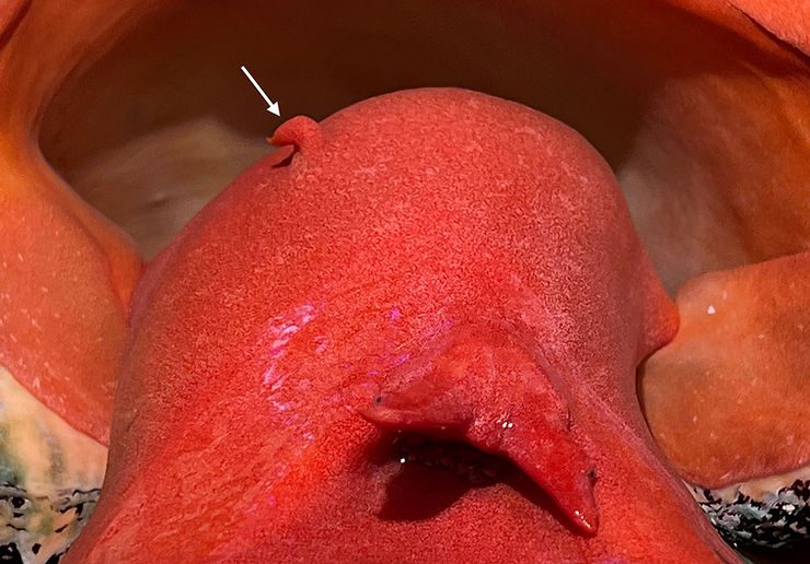 Imposex-affected female Triplofusus giganteus. Arrow points to pseudo-penis. Photo: Carly Hulse.